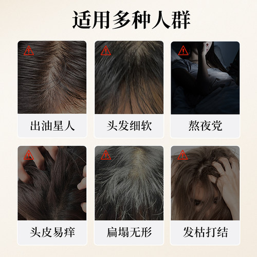 章光101控油无患子洗发水扁塌男士洗发水 - 图2
