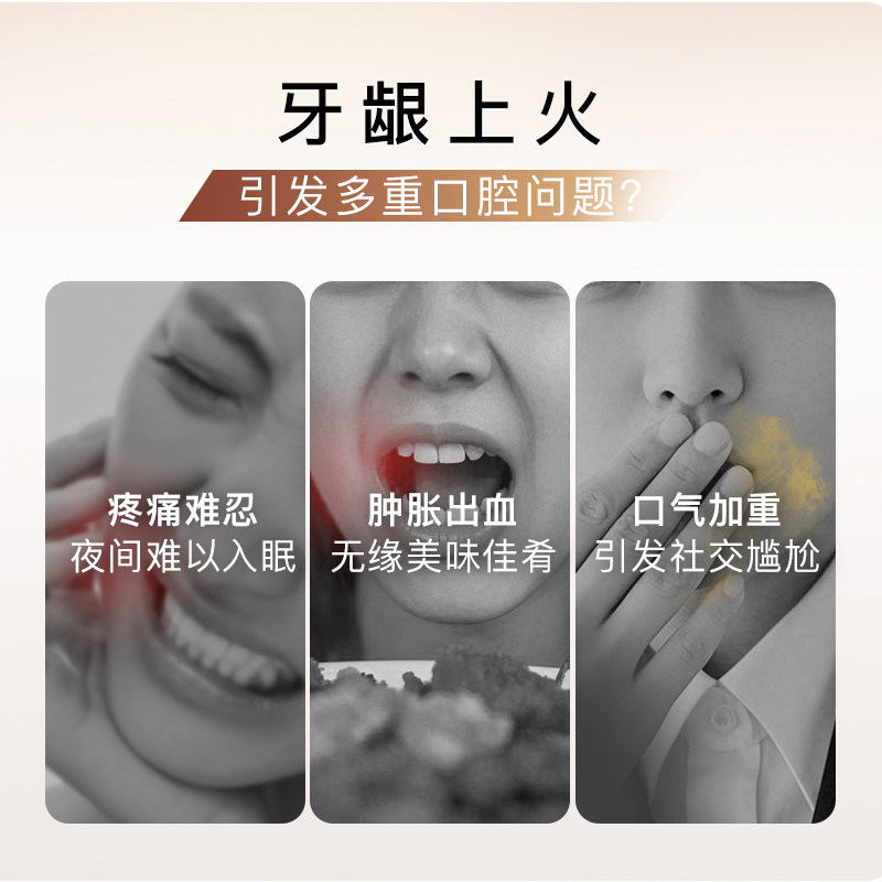 【肖战同款】舒客去火牙膏植萃养龈三七草本护龈清火清新口气成人