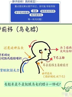 脖子前倾矫正器颈椎防低头神器