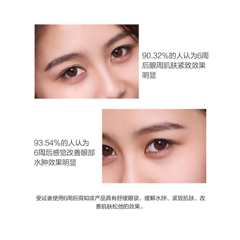 马应龙去消减去淡化黑眼圈细纹眼霜 马应龙八宝眼霜