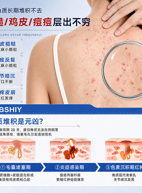 【ally同款】韩国红钻身体注氧抛光清洁体膜刷酶去角质搓澡巾鸡皮