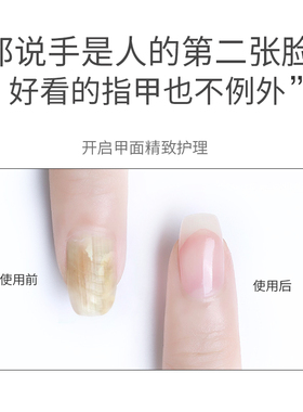德国正品防霉菌素修护液