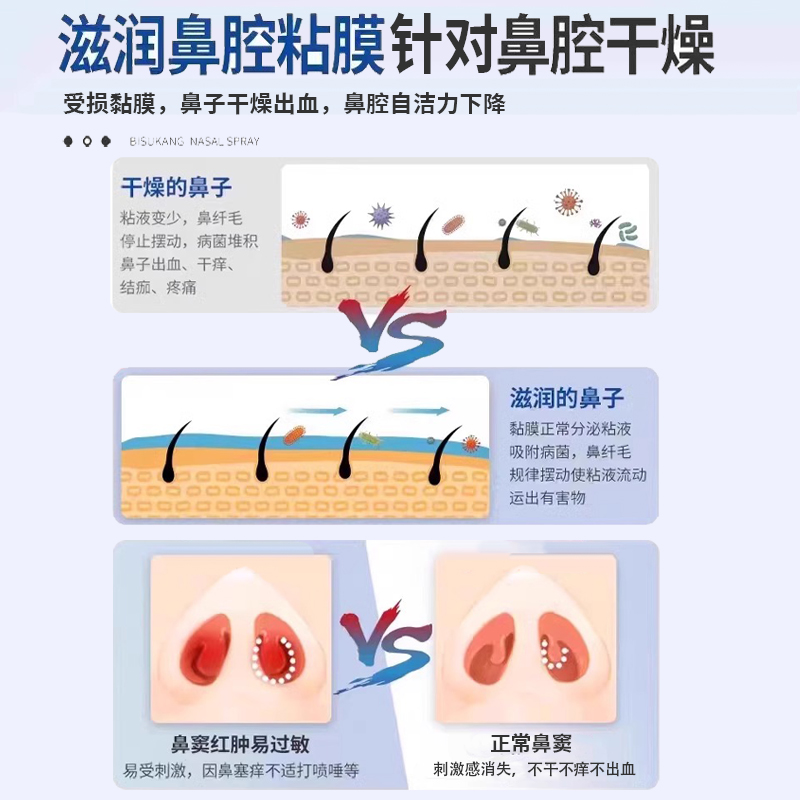 鼻子鼻孔干燥出血结痂干痒滋润保湿鼻腔喷雾干燥性鼻炎鼻黏膜受损-图3