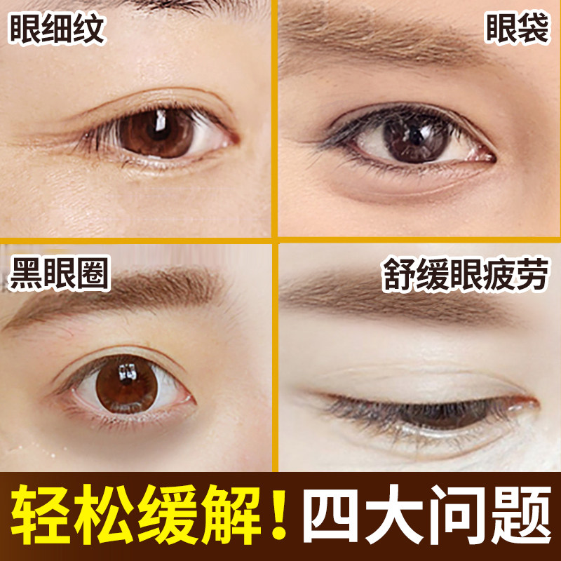 梵西六胜肽抗皱紧致保湿淡化眼袋 fonce梵西聚美名妆眼膜