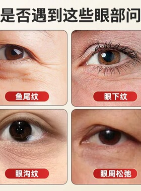 小莲蓬按摩头眼部保健舒经活络明目美容刮痧铜珠点穴棒