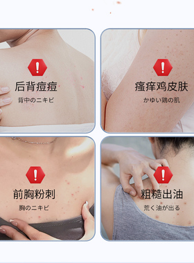 岩井昃弘药背粒消官方旗舰店前胸后背部祛痘痘喷雾立除螨胸前长