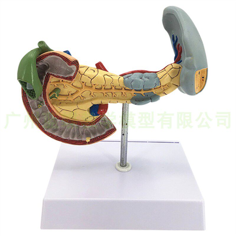 教学仿真病变胰脾肝胆十二指肠模型病理胰腺标本胰脾肝胆解剖_虎窝淘