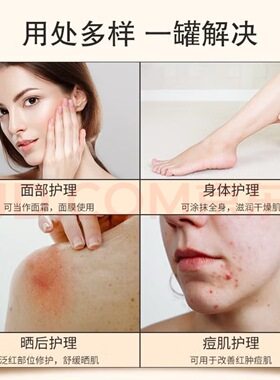 韩国施姈98%芦荟胶芦荟保湿凝胶祛痘补水护肤保湿男女晒后修护