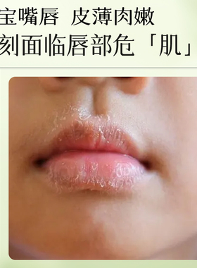 宫佩宝宝特护润唇膏滋润保湿防干裂男女孩儿童专用秋冬