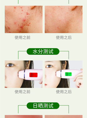 凝胶补水保湿修复舒缓