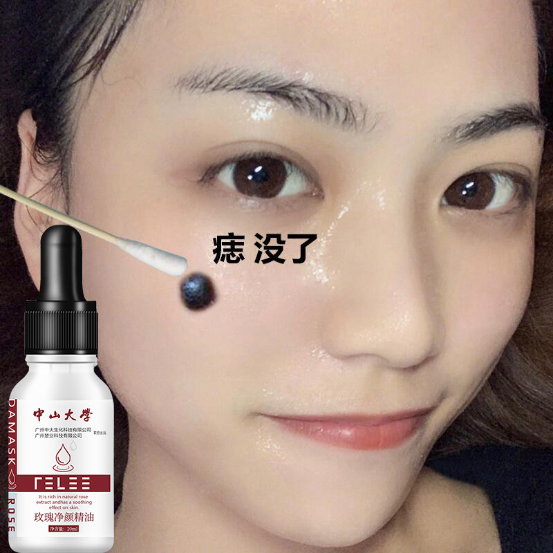 小红书推荐净颜158三瓶一疗程精油 bidailanka单方精油