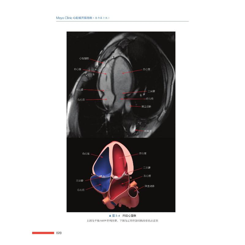Mayo Clinic心脏磁共振指南原书第2二版心血管成像治疗心脏疾病临床诊断书籍影像学核磁MRI磁共振成像技术中国科学技术出版社-图2
