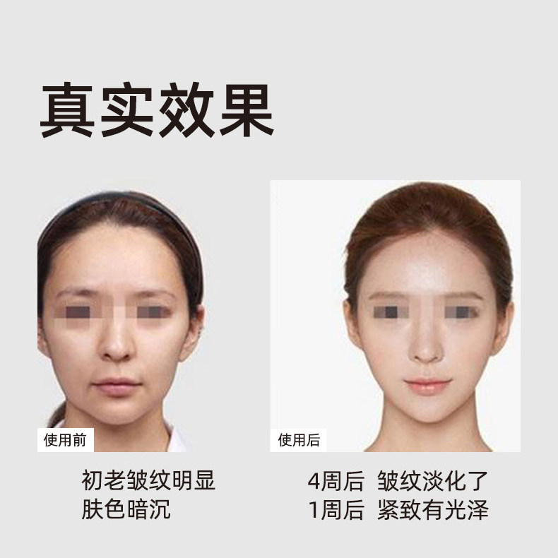 goodwind美容仪器家用洗脸清洁面部超声波导入仪导出提拉紧致按摩,淘宝优惠券,粉丝福利购,淘宝优惠卷