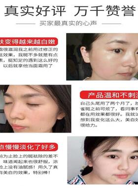 老牌子白里透红美白补水祛斑霜去斑祛黄褐斑雀斑官方正品早晚霜