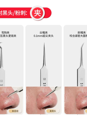 张小泉超尖抗菌粉刺夹去黑头
