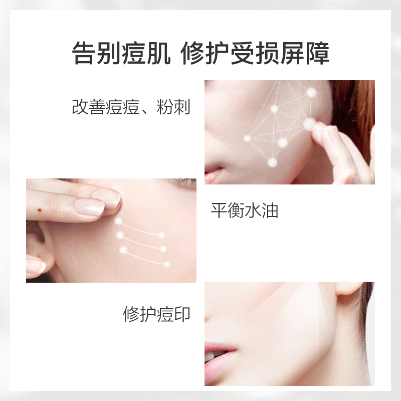 阿芙官方旗舰店阿芙茶树祛痘纯露 敏感肌痘痘痘印补水保湿喷雾护肤湿敷收缩毛孔1