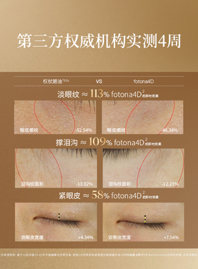 【King哥直播间】阿芙十一籽眼油紧致淡纹眼部精华油D15