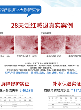 丁家宜B5补水晒后修护敏感肌面膜