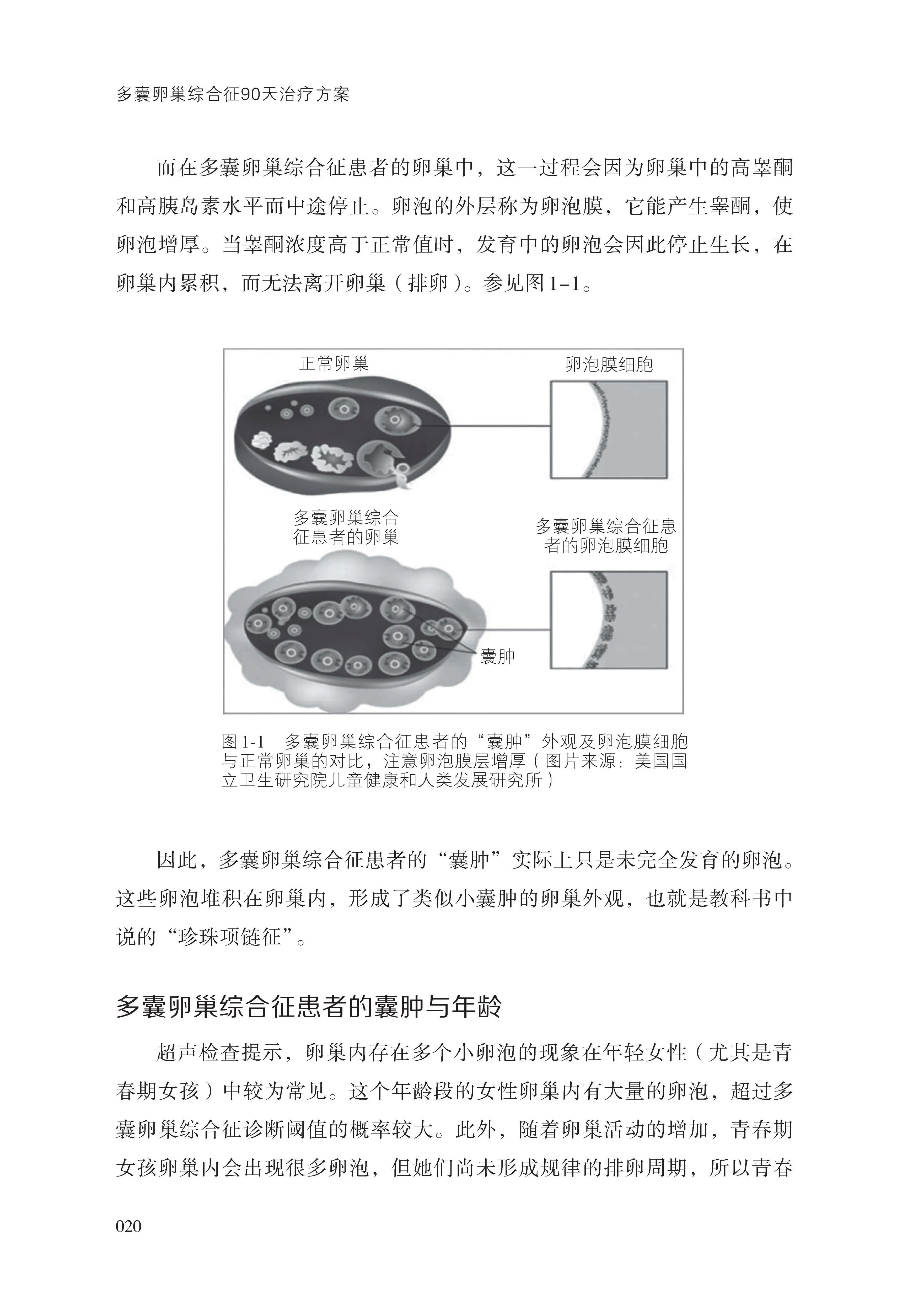 多囊卵巢综合征90天治疗方案 20年功能医学临床经验专业详尽剖析多囊 8步治疗方案保护女性健康北京科学技术-图1