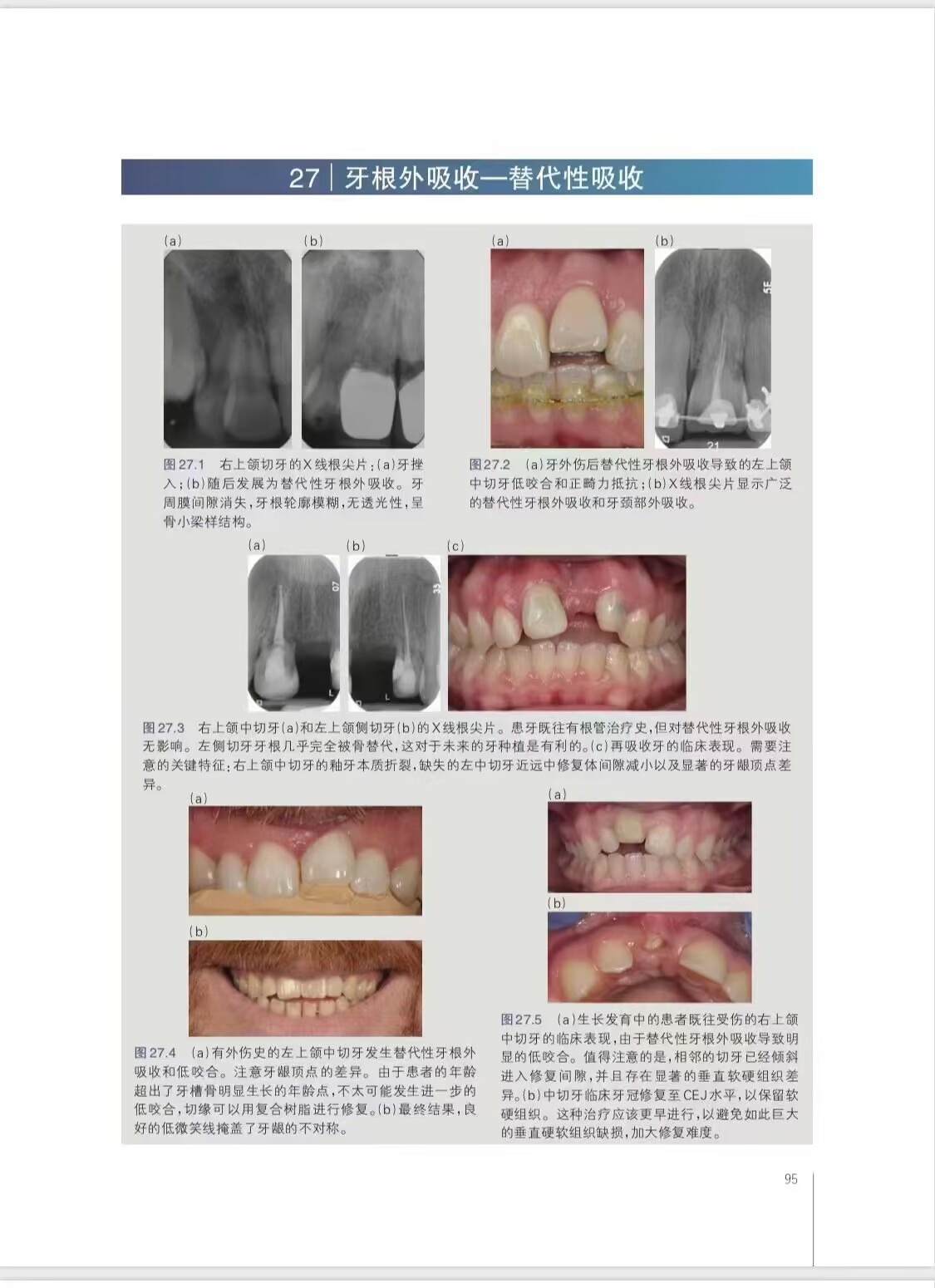 正版包邮 牙外伤临床指南 杨凯 译 口腔学 口外牙医口腔医生拔牙种植修复根管牙周 重庆出版社9787229175726 - 图2