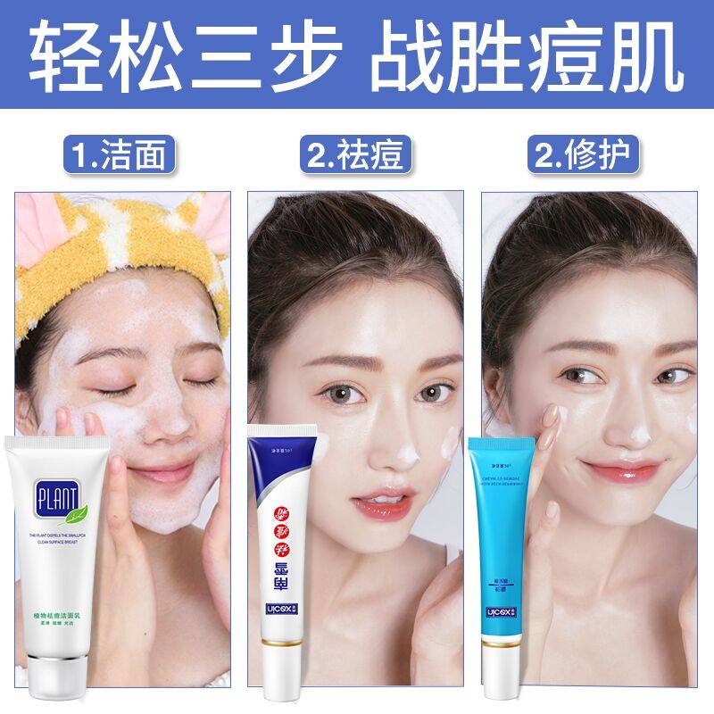 南雪正品三合一祛痘套装修复祛痘霜 nicex南雪乳液/面霜