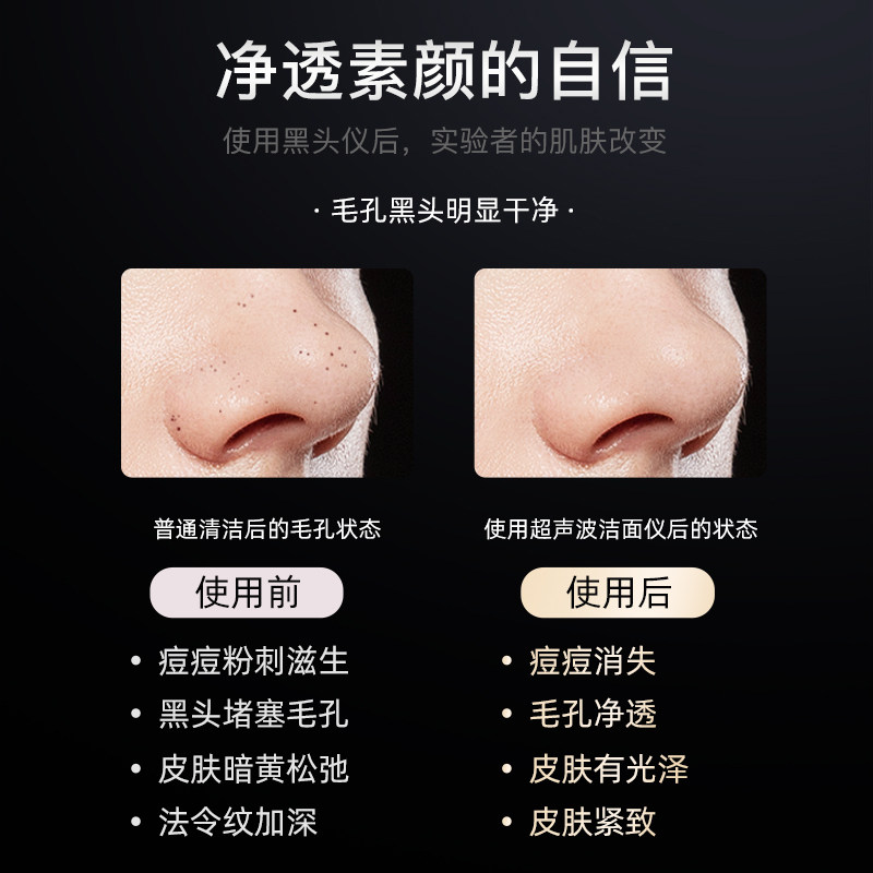 oes超声波清洁吸出器家用美容仪 oes电子美容仪