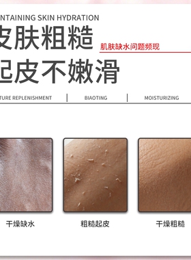 标婷维E乳280g保湿补水全身润肤