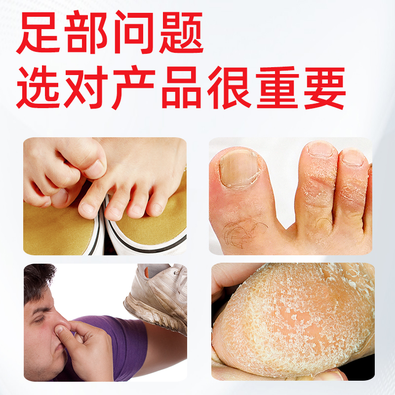 ⭐⭐脚医生旗舰店脚气喷剂脚臭脚痒脚汗脱皮水泡专用手癣足癣