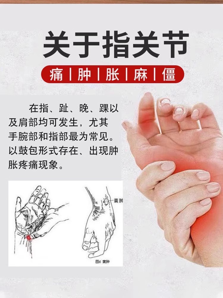 手指关节变形肿大粗大疼痛僵硬修复美手变细变长热敷神器专用药膏-图3