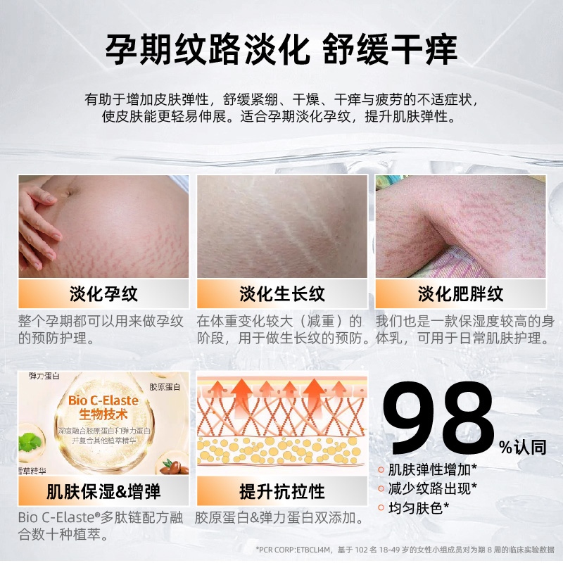 帕玛氏妊娠纹护理精华油100ml 孕妇专用预防淡化妊辰纹怀孕抚纹油