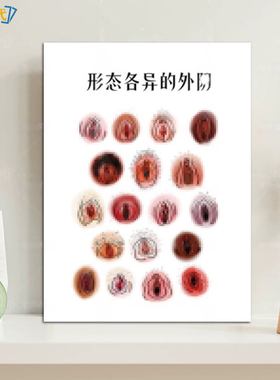 男女私密九型图装饰画抽象九大名器医疗美容阴道自测松弛检测挂画