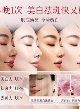 雀斑黄褐斑克星！专业淡斑面霜