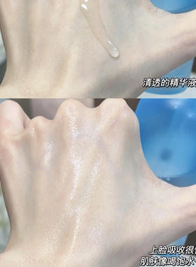福瑞达诠润B5精华滋润修护泛红