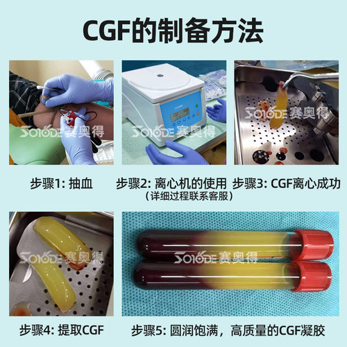 赛奥得牙科离心机CGF口腔专用种植器械促进伤口愈合牙骨创伤成骨 - 图0