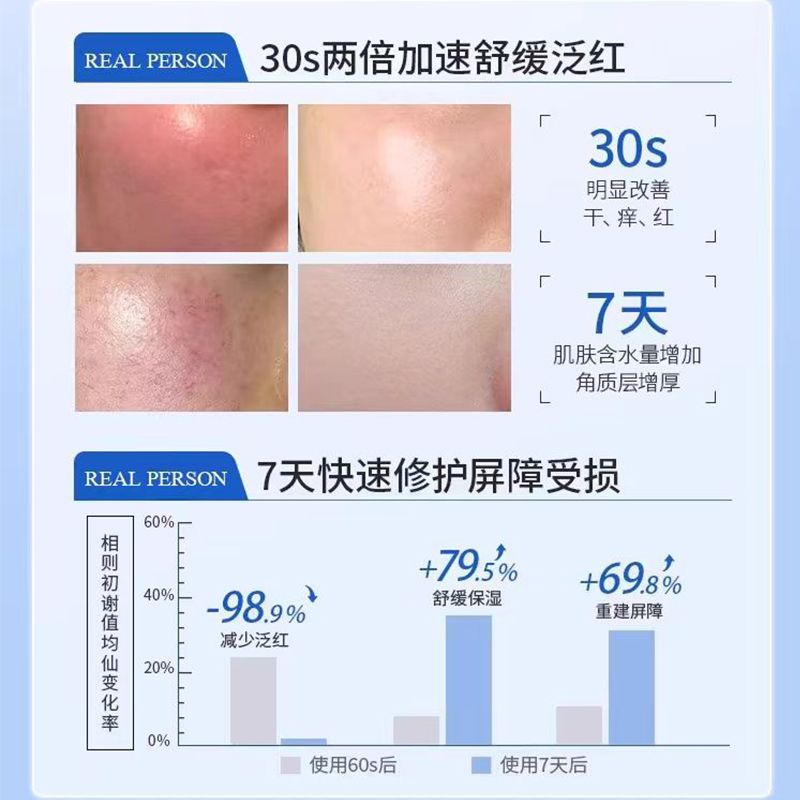 过敏皮肤修复脸部医用脸过敏红痒面膜敏感肌春季泛红干痒急救EF-图1