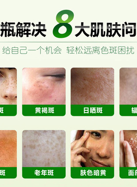 无锡红白瓶中草药祛斑霜美颜套装红加白保湿美白去晒斑雀斑黄褐斑