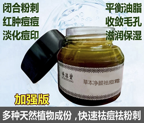 祛封闭闭合性闭口粉刺白头黑头发红痘痘暗疮痤疮消豆淡化痘印螨虫 - 图0