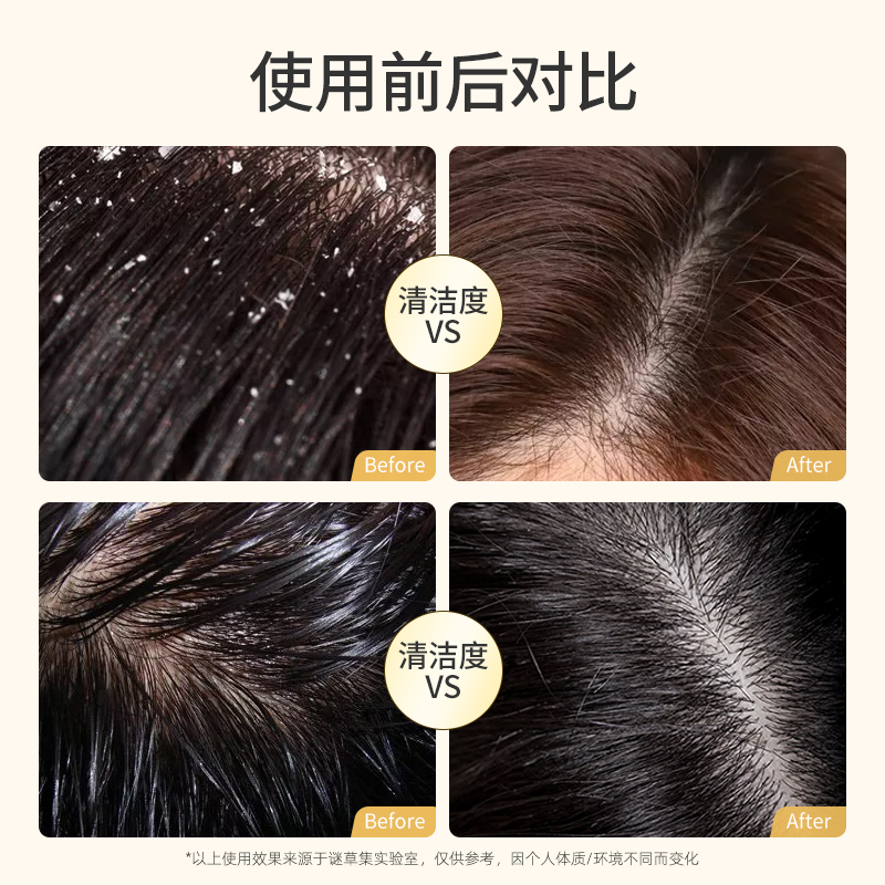 谜草集旗舰店牛奶洗发水去屑止痒控油蓬松柔顺改善毛躁去油持久留香沐浴露套装2