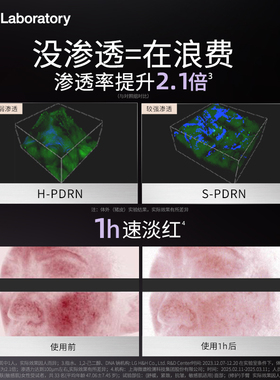 【双11抢先购-自播专享】CNP希恩派致研紧致肌源pdrn精华修护针修