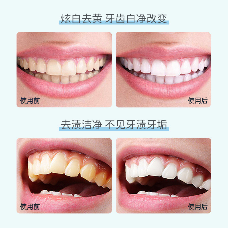 VSHELL植贝小苏打去渍清新牙粉去黄口臭洗白除牙石清洁口腔正品A1 - 图2