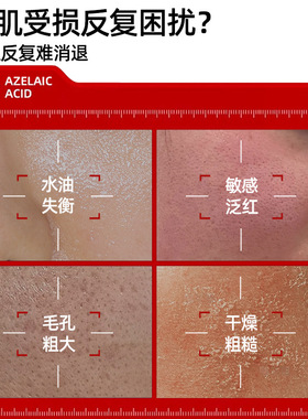 【山姆断货王】20%壬二酸祛痘膏