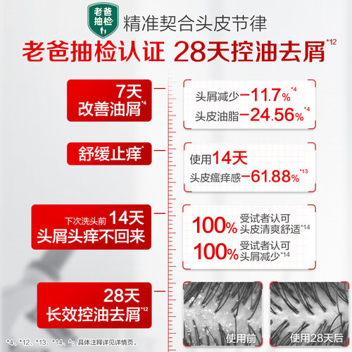 【b2v&老爸抽检】去油屑套装去屑控油止痒蓬松洗发水二硫化硒洗发 - 图2