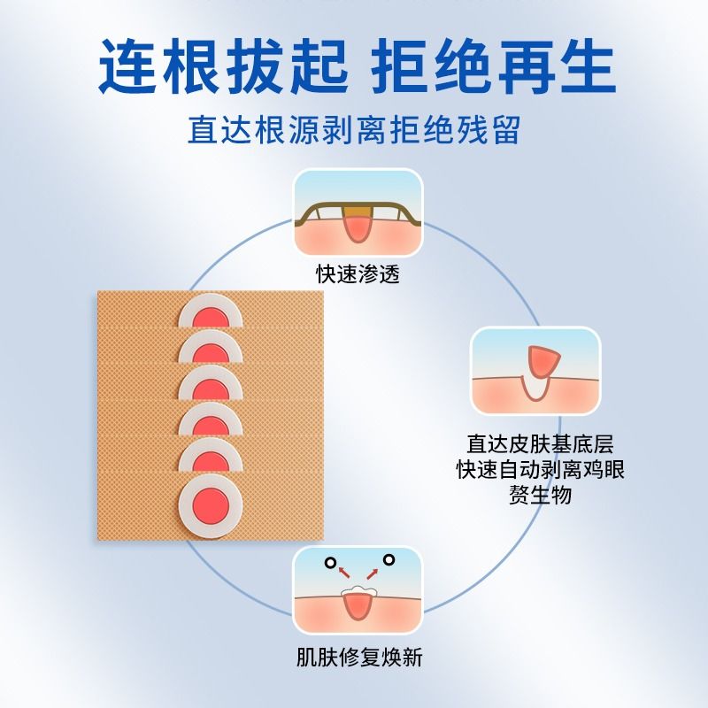 云南本草鸡眼贴鸡眼膏瘊子足部去脚底脚趾手部跖疣疣灵老茧根肉刺 - 图1