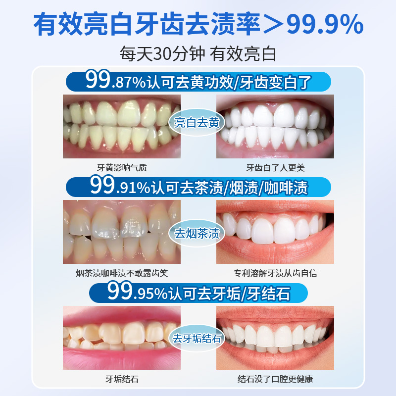 佳琦推荐美白牙贴去黄洁白牙齿速效亮白清洁牙黄烟渍茶渍贴片神器 - 图1