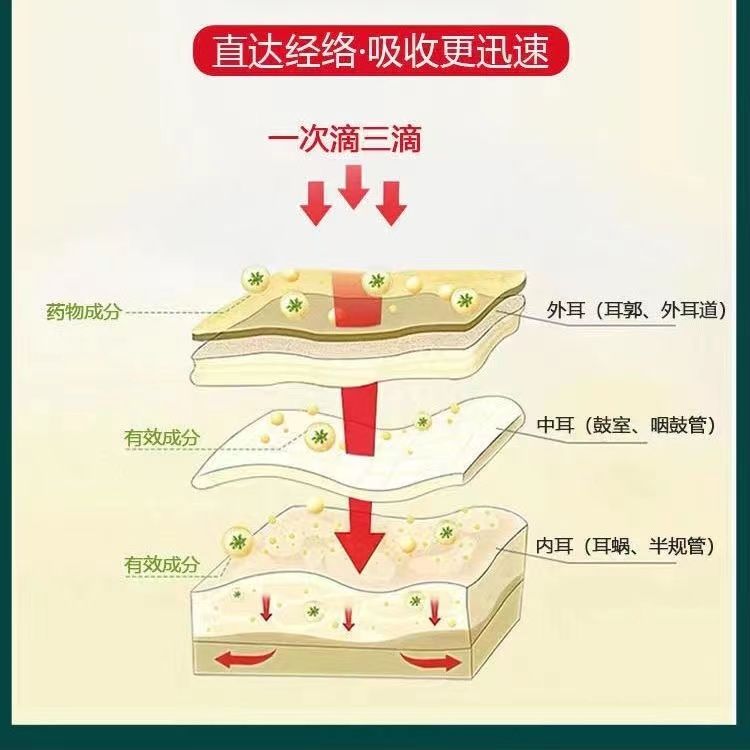 滴耳液人用耳朵痒中耳道炎消药清洁液清洗液油耳鸣耳屎软化液抑菌 - 图1