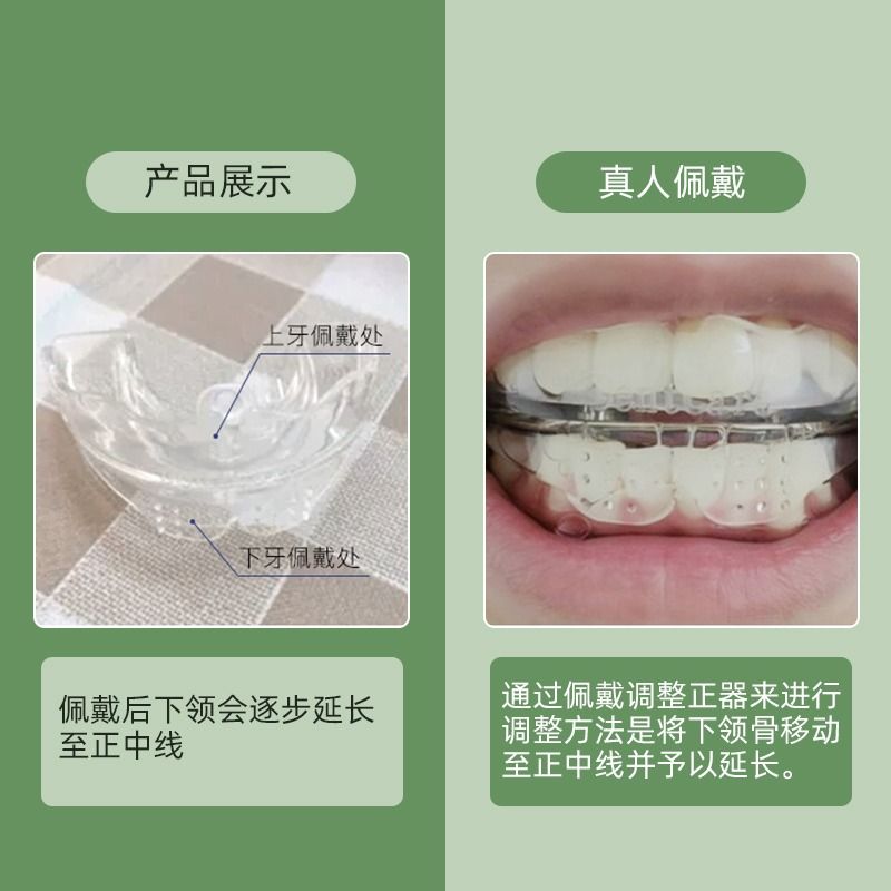 下巴后缩矫正器前突短错位过长调整下颌线歪斜纠正带神器牙套家用 - 图1