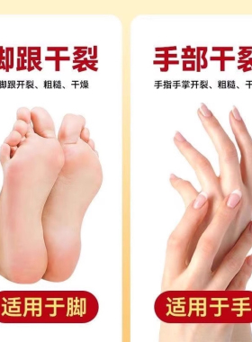 专裂脚后跟干裂起硬皮足跟开裂真菌修复霜药膏抑菌滋润软化角质