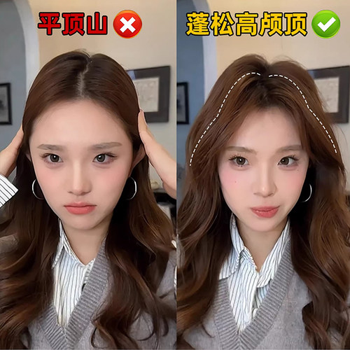高颅顶神器头发蓬松夹女垫发根固定发夹发卡头饰夹子风塑梳刘海夹 - 图0