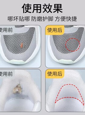 运动鞋后跟破洞修补贴修复磨损防掉防磨脚男女鞋后跟内衬补丁神器