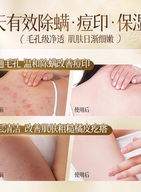硫磺控油净肤沐浴露旗舰正品